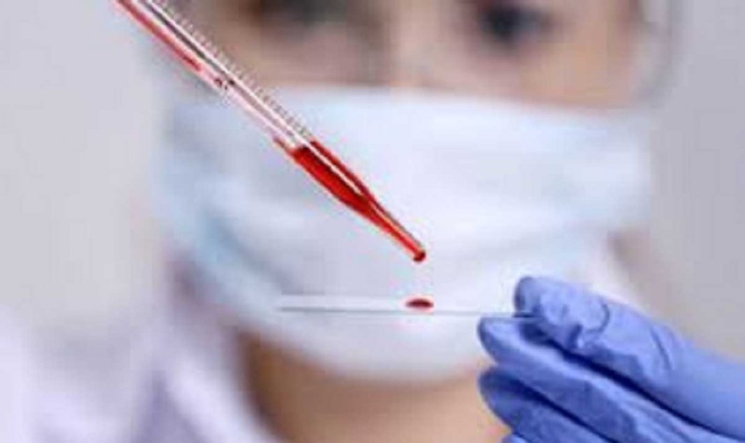 Exames de sangue podem substituir biópsias e ressonâncias magnéticas