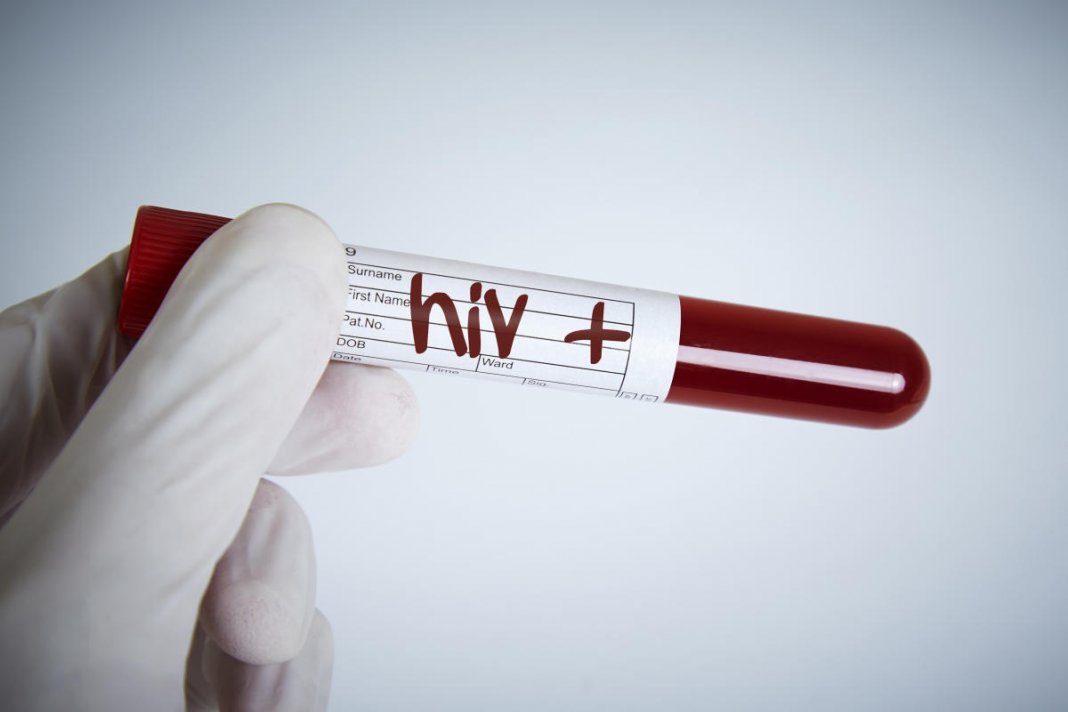 Cura da AIDS à vista? Cientistas conseguem eliminar HIV do genoma pela primeira vez