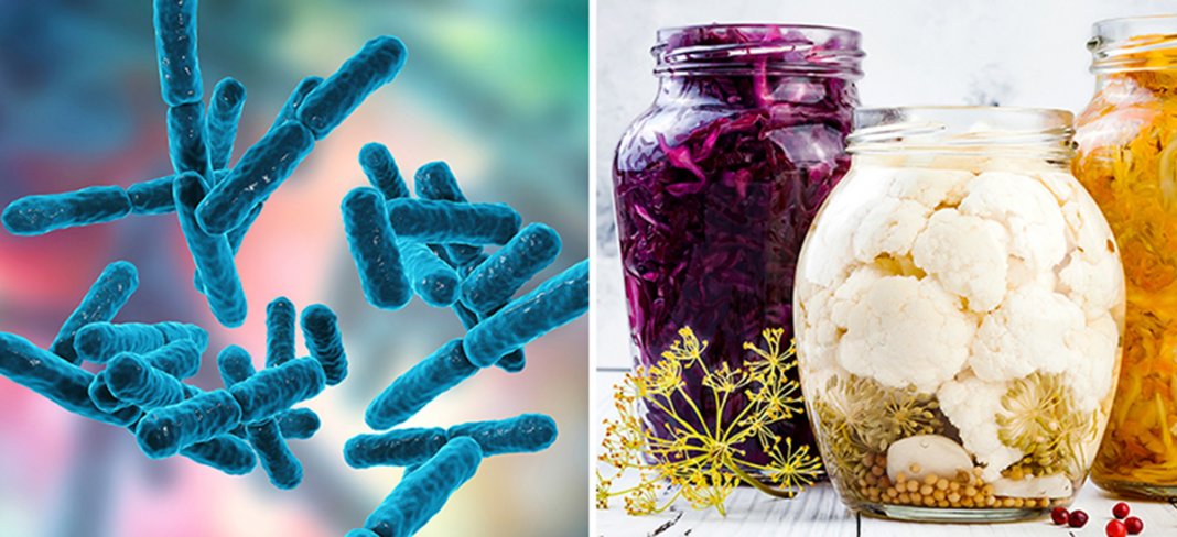 10 Benefícios para a saúde de probióticos, para o intestino, cérebro e mais