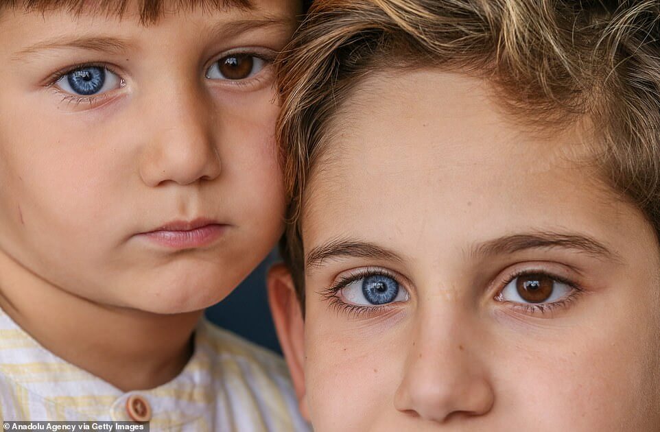 Irmãos nascem com um olho de cada cor e fotos impressionam