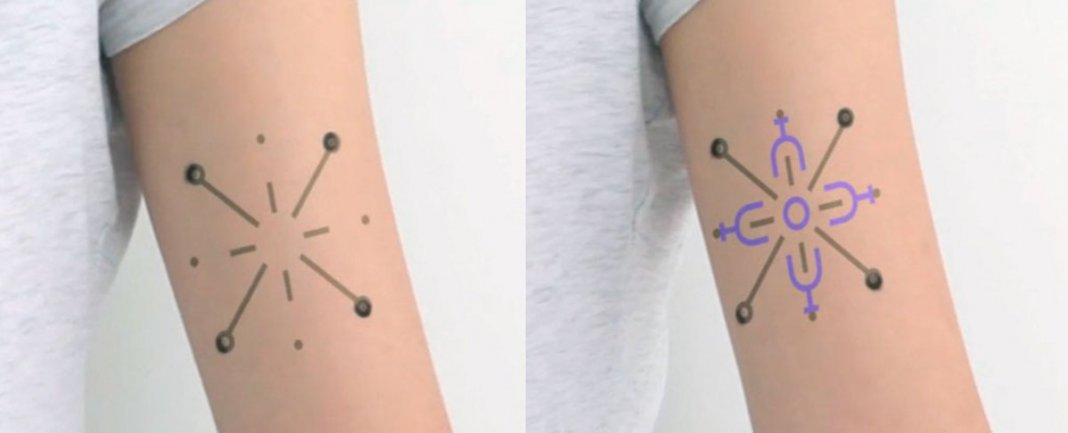 Tatuagem para diabéticos muda de cor, de acordo com os níveis de açúcar no sangue