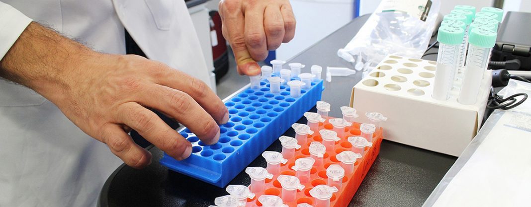 Novo método detecta câncer de próstata por meio da urina