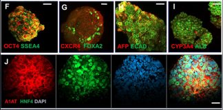 Combinação inovadora de célula-tronco e impressão 3D produz minifígados para transplante