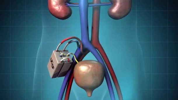 Kidney 610x343 1 - Este rim artificial pode eliminar a necessidade de diálise renal