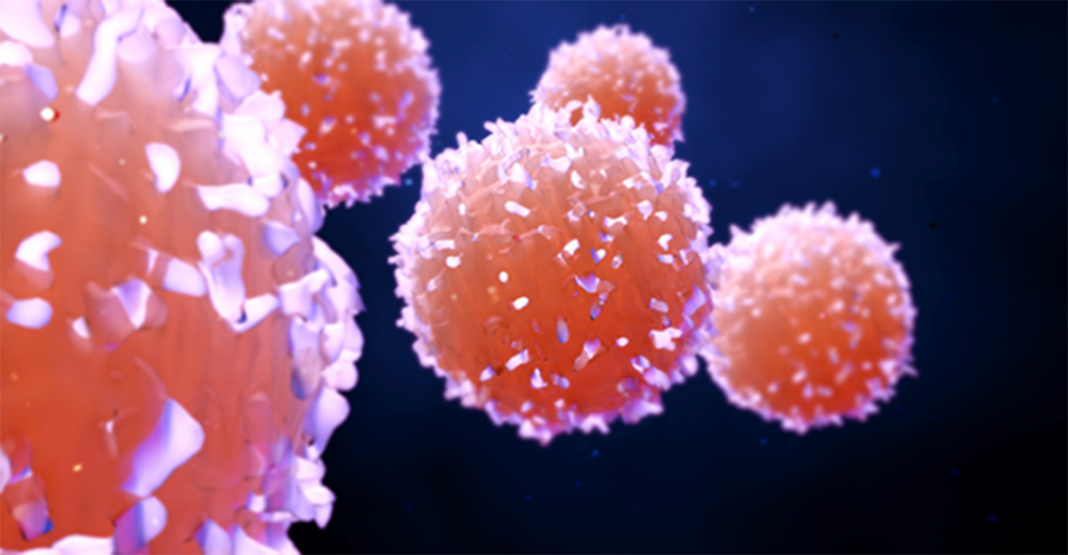 Cientistas criam ultrassom que mata células cancerígenas