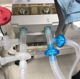 revistasaberesaude.com - Hospital transforma seu único ventilador em nove, com alguns recursos de bricolagem
