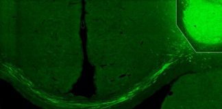 Neurobiologistas conseguiram reverter os danos por acidente vascular cerebral usando células da pele humana