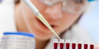 Teste de sangue para câncer ’10 vezes mais sensível’ do que métodos anteriores