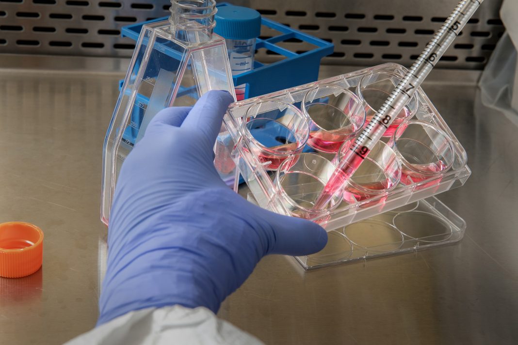 Cientistas descobrem como converter sangue tipo A em um tipo universal com ajuda de enzimas bacterianas