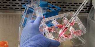 Cientistas descobrem como converter sangue tipo A em um tipo universal com ajuda de enzimas bacterianas