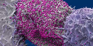 Cura do HIV em “paciente de São Paulo” intriga cientistas que pedem cautela