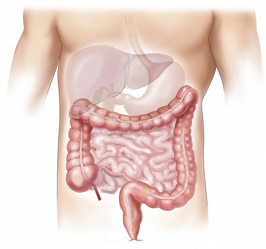 Dieta rica em gordura com uso de antibióticos ligada à inflamação intestinal