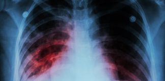 Aplicativo criado na USP faz o diagnóstico da covid-19 a partir de radiografia do pulmão