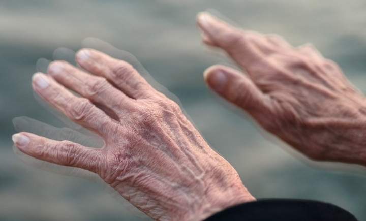 Os sintomas de Parkinson são a única maneira de diagnosticá-lo; mas não por muito