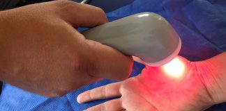 Laser e ultrassom conjugados combatem sintomas da fibromialgia