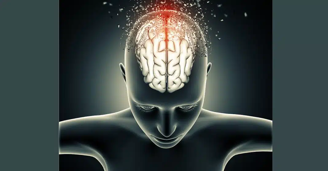 Uma forma aprimorada de biópsia líquida desenvolvida para tumores cerebrais
