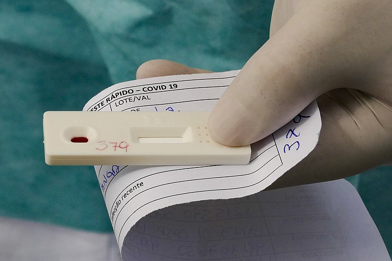 Plano de teste radical pode ‘conduzir a epidemia rumo à extinção’ em semanas, afirma estudo