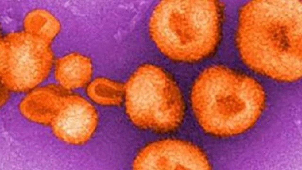 Vírus que causa febre fatal em humanos é descoberto na Bolívia