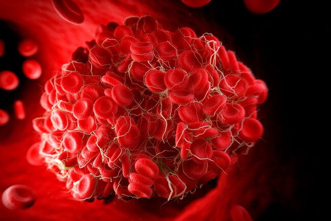 1800ss science source rf blood clot - Como seu tipo sanguíneo pode afetar sua saúde