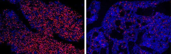 revistasaberesaude.com - Molécula de DNA projetada ajuda a encontrar células-tronco cancerosas no sangue