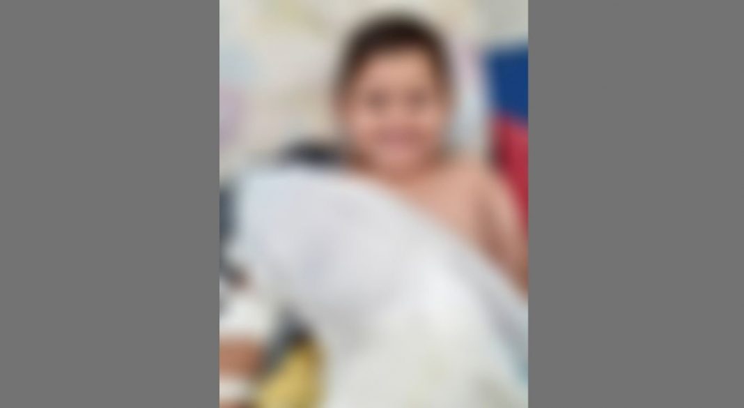 Criança morre após receber 4 anestesias para enfaixar um braço
