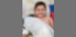 Criança morre após receber 4 anestesias para enfaixar um braço