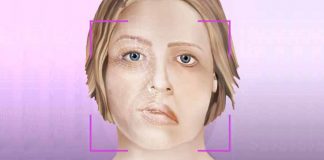 Aplicações de laser e vácuo revertem paralisia facial sem uso de medicamentos