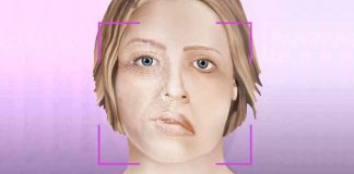 Aplicações de laser e vácuo revertem paralisia facial sem uso de medicamentos