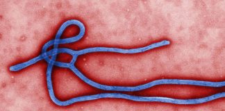 Novo surto de ebola sugere que o vírus pode se esconder por anos dentro das pessoas