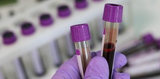 Cientistas desenvolvem novo exame de sangue que pode diagnosticar seu nível de depressão