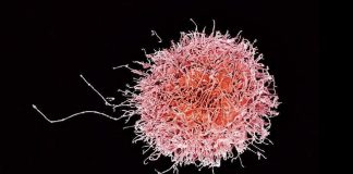 As células do nosso corpo têm ‘uma licença para morrer’, protegendo-nos de doenças infecciosas