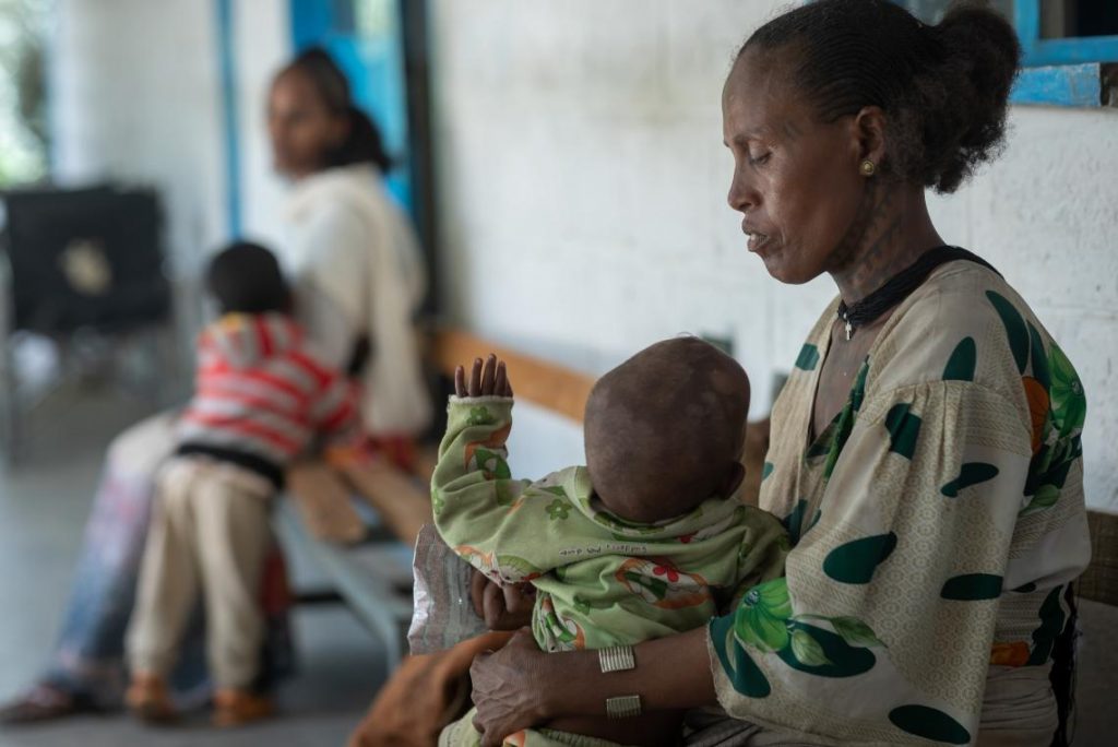 revistasaberesaude.com - Severa crise nutricional atinge famílias da região do Tigré (Etiópia)