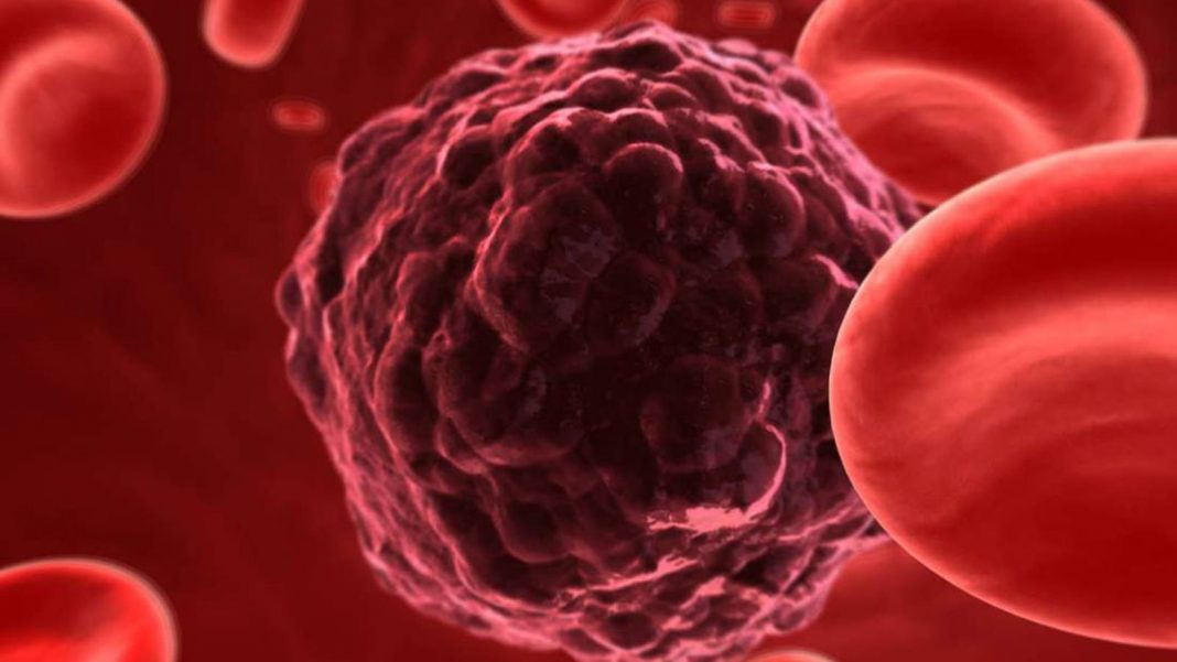 Novo exame de sangue pode encontrar 50 tipos de câncer