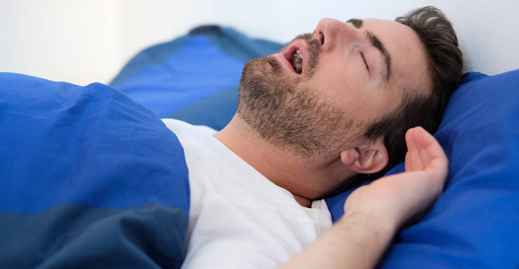 Gravidade da apneia do sono reduzida pela reutilização de medicamentos existentes