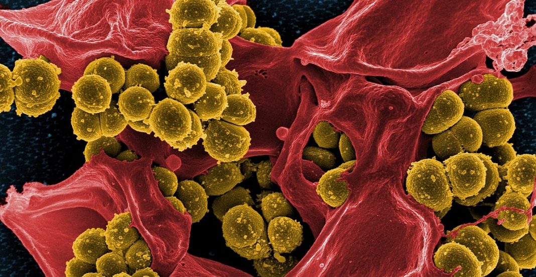 Moléculas produzidas por bactérias intestinais podem ajudar o corpo humano a combater o câncer