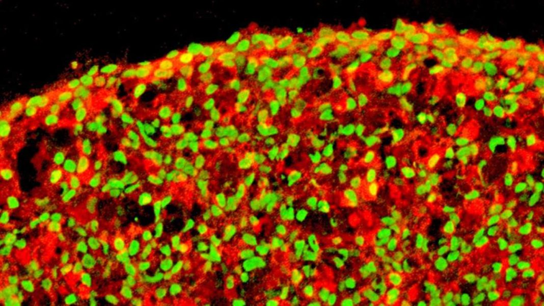 A ‘cura’ baseada em células-tronco para o diabetes tipo 1 está mais próxima