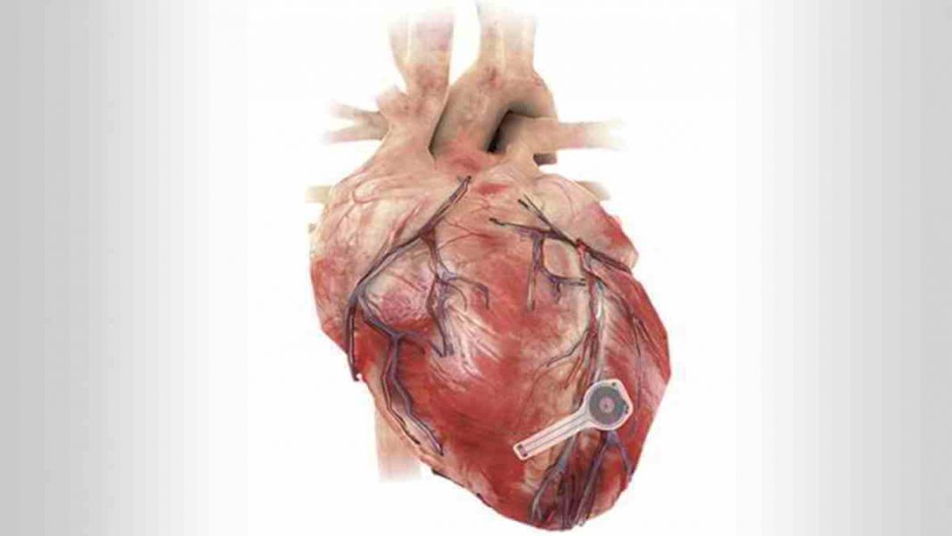 Pesquisadores criam o primeiro marcapasso sem chumbo e bateria que se biodegrada quando não é mais necessário