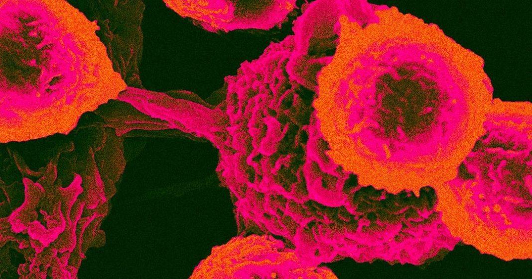 Cientistas afirmam que encontraram uma proteína ligando todos os cânceres