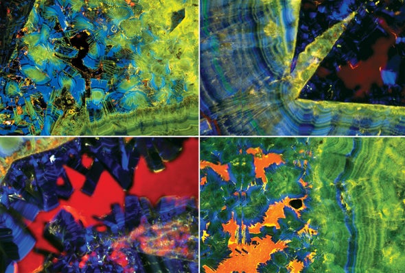 Cientistas usam conhecimentos de geologia para tratar cálculos renais revistasaberesaude.com - Cientistas usam conhecimentos de geologia para tratar cálculos renais