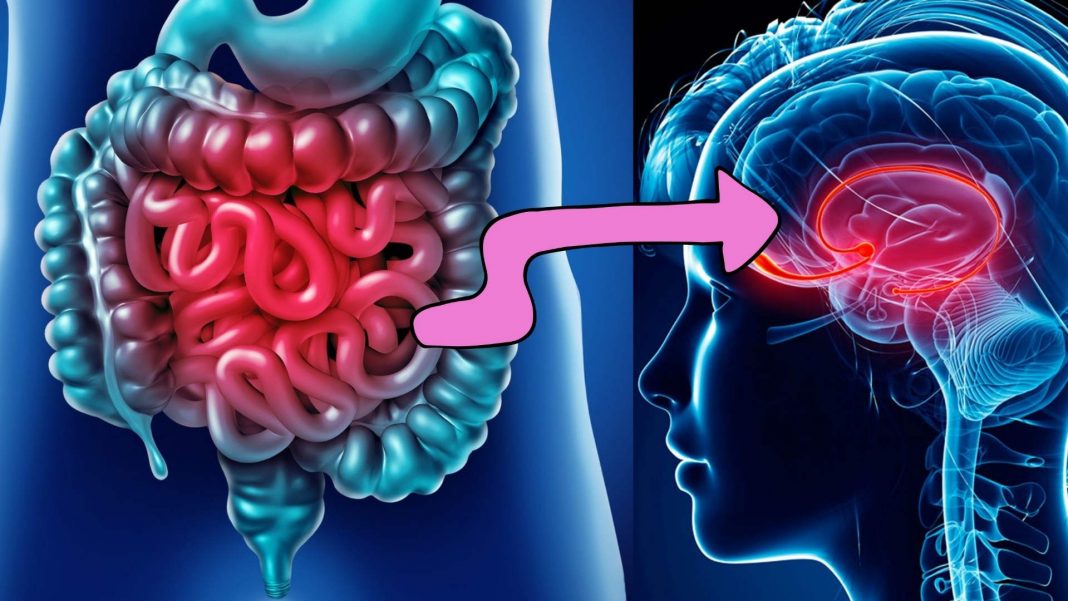 Depressão, transtorno bipolar e esquizofrenia compartilham semelhanças nas bactérias intestinais