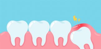 Cientistas finalmente sabem por que os dentes do siso surgem apenas quando somos basicamente adultos