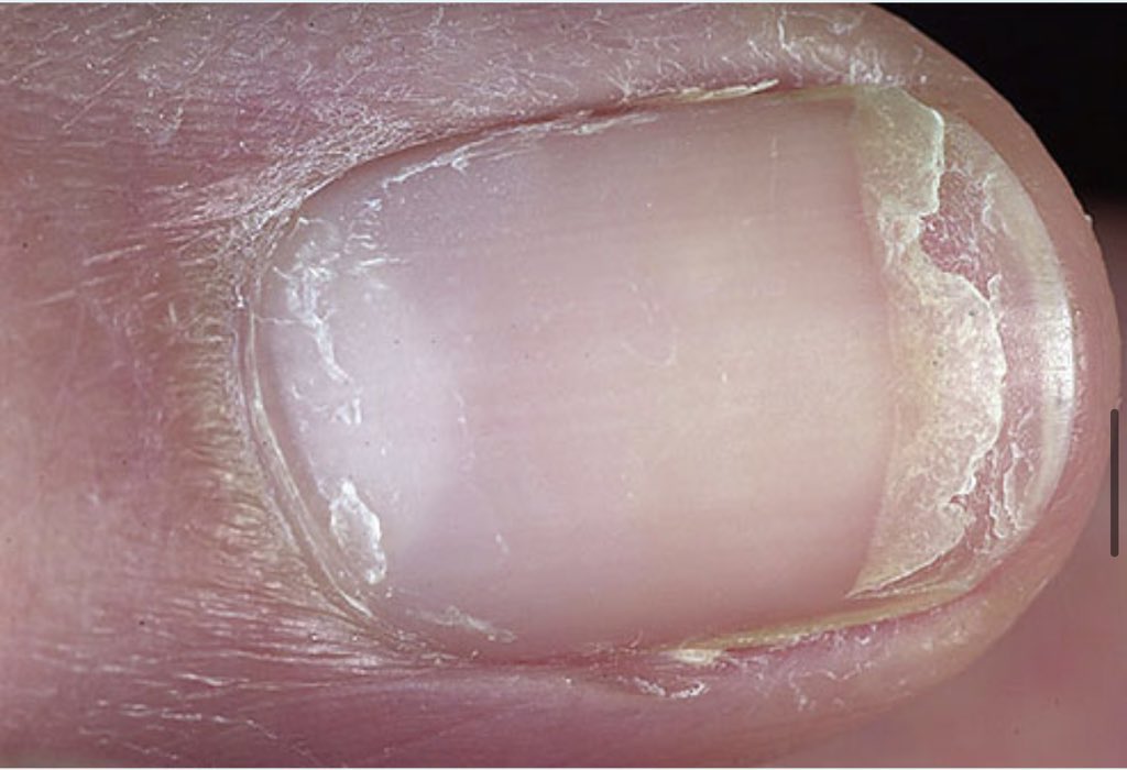 O que suas unhas dizem sobre sua saúde Ew6fFlEXEAAQdNJ - O que suas unhas dizem sobre sua saúde