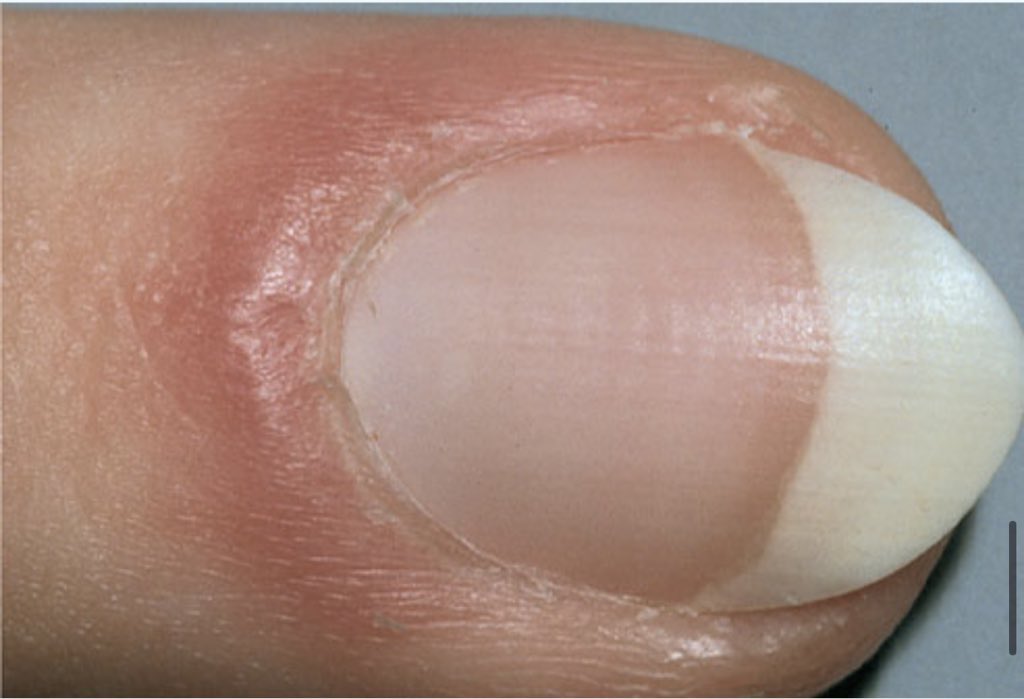 O que suas unhas dizem sobre sua saúde Ew6fGC7WgAEaf4R - O que suas unhas dizem sobre sua saúde