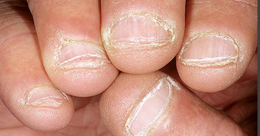 O que suas unhas dizem sobre sua saúde b98a001a681cb19c423205af42b80dcf 1024x538 - O que suas unhas dizem sobre sua saúde