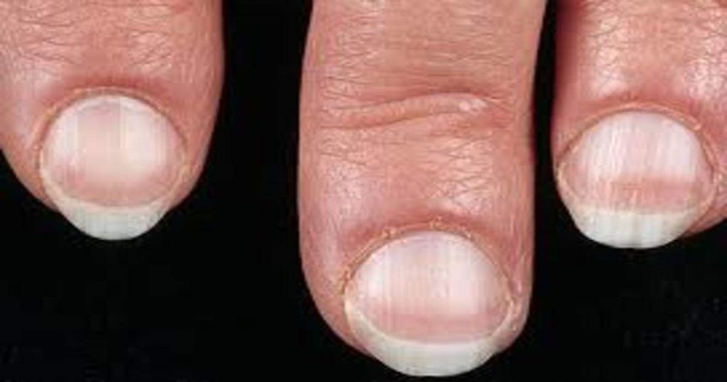 O que suas unhas dizem sobre sua saúde photogallery 1024x538 - O que suas unhas dizem sobre sua saúde