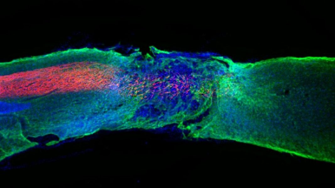 Em uma feito surpreendente, uma novo experimento reverteu a paralisia em camundongos com lesão na medula espinhal