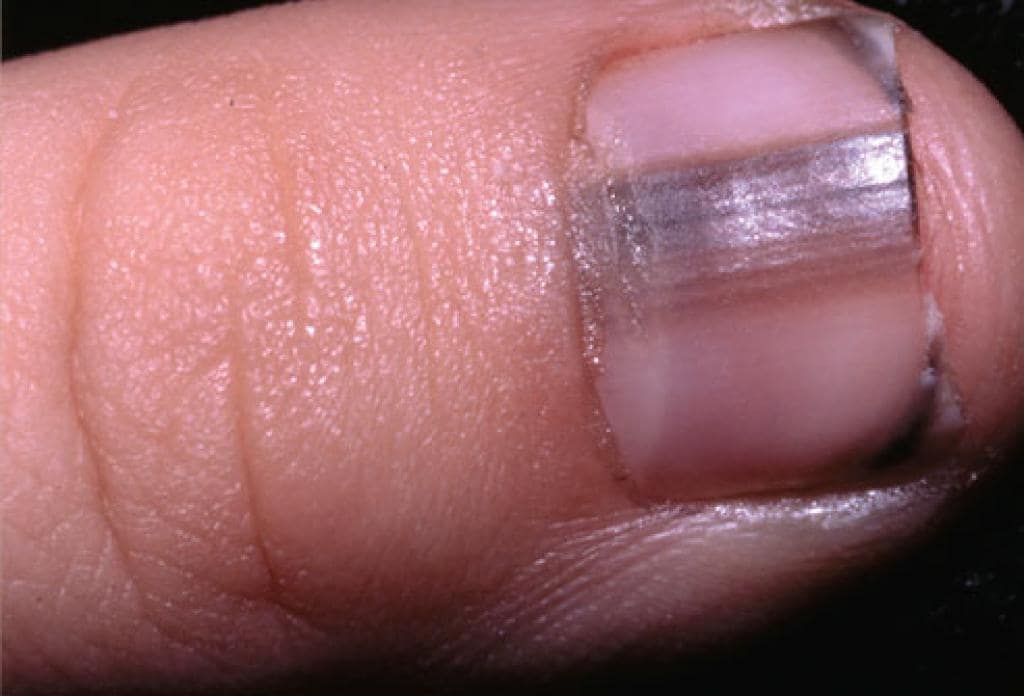O que suas unhas dizem sobre sua saúde v organizme - O que suas unhas dizem sobre sua saúde