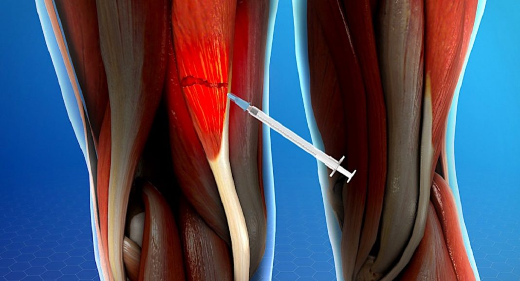 Um novo hidrogel comparável aos nossos tecidos e potencialmente inalterável para nos “reparar”