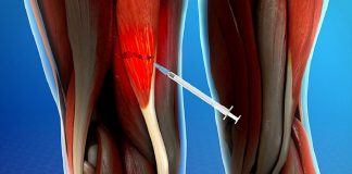 Um novo hidrogel comparável aos nossos tecidos e potencialmente inalterável para nos “reparar”