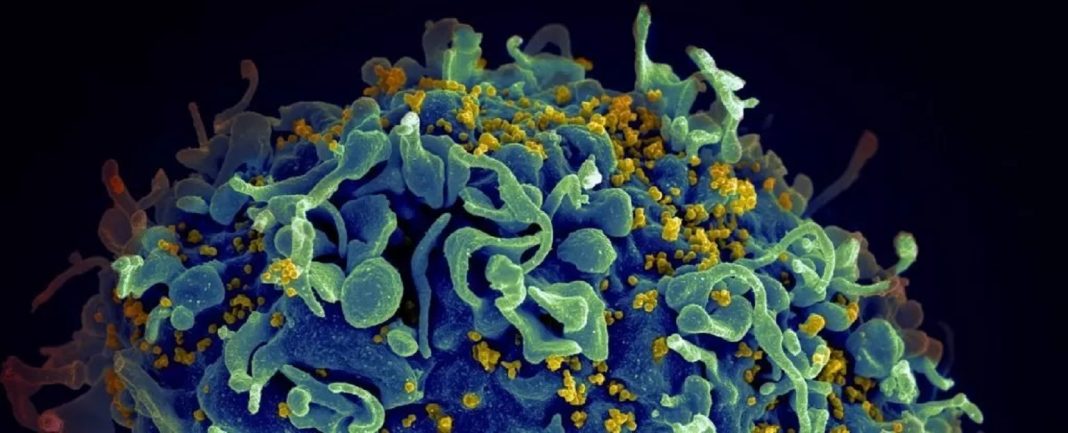 Medicamento contra o câncer elimina o HIV latente, revela novo estudo empolgante
